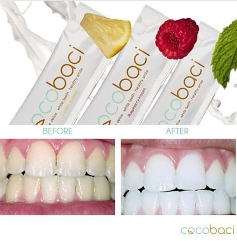 62% off on 15 Day Teeth Whitening Smile Therapy Pack | OneDayOnly