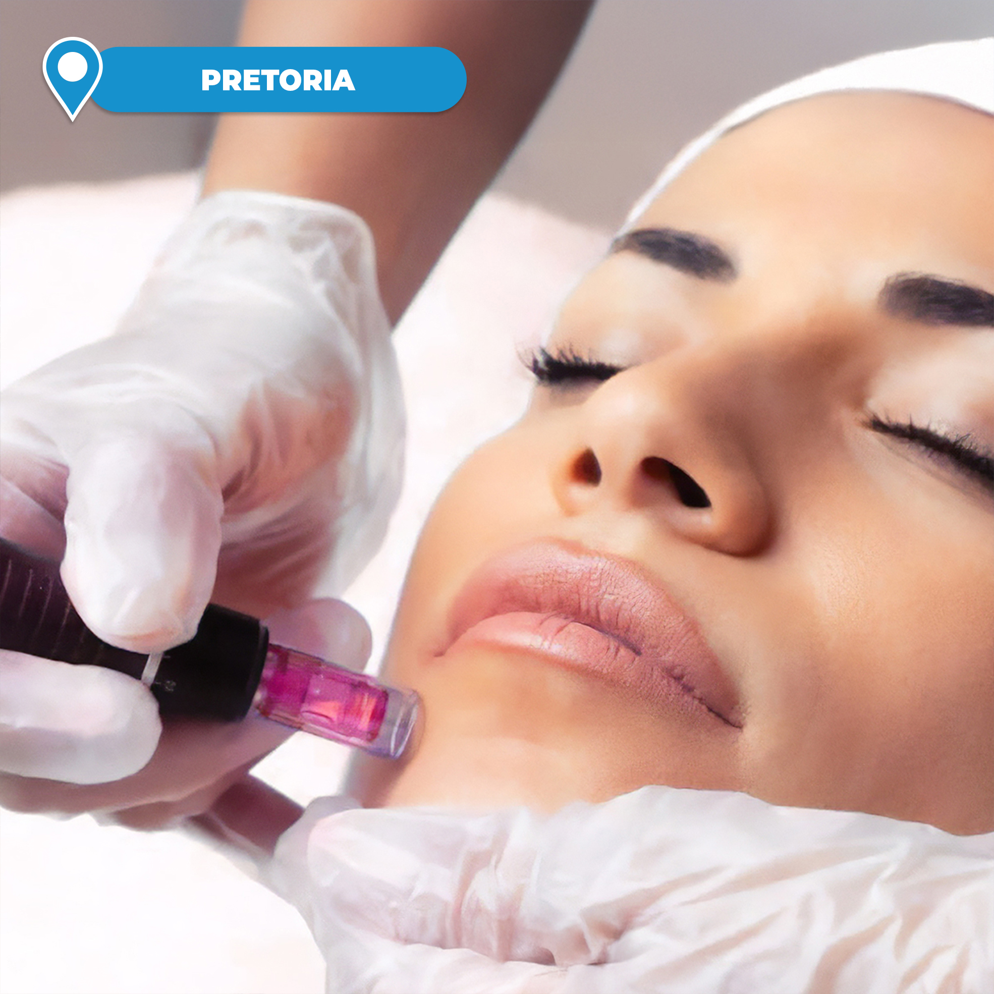 Micro-Needling Packages