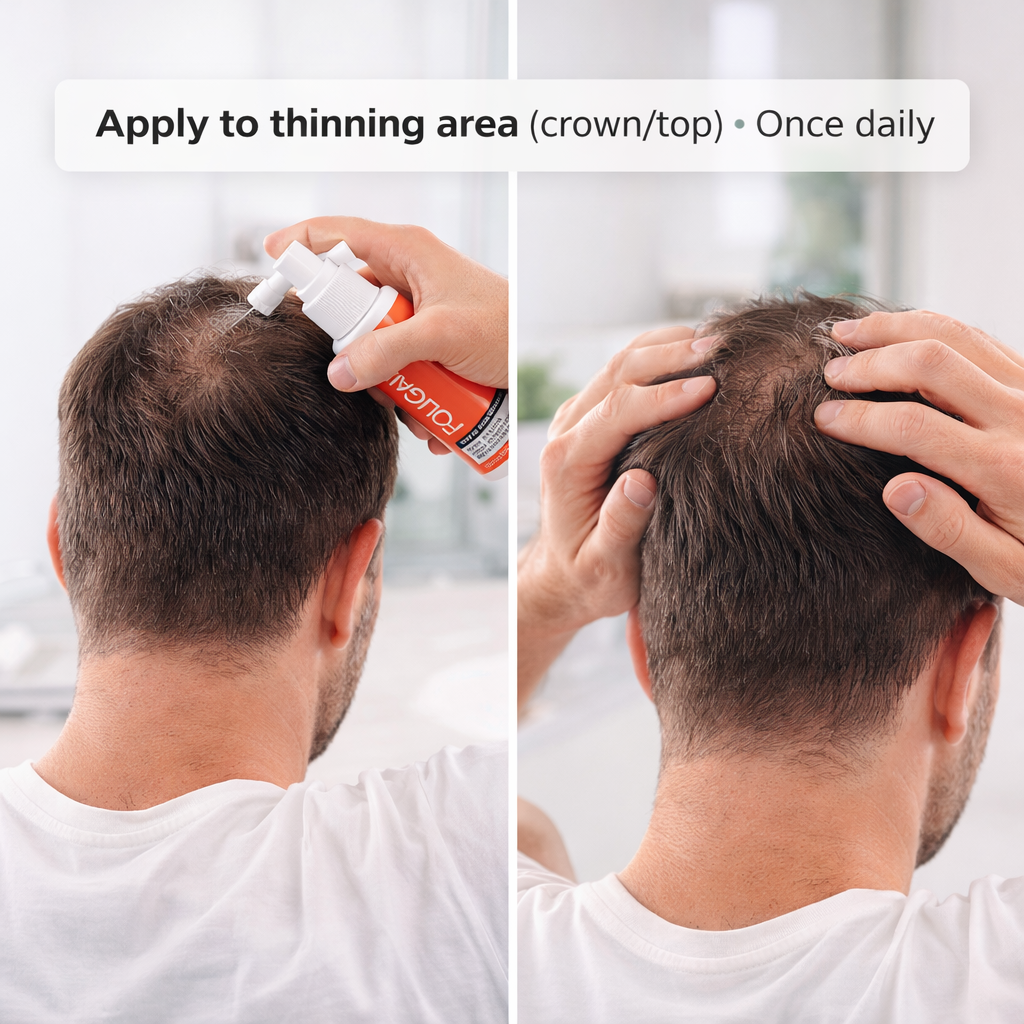 27% off on 59ml Formula for Thinning Hair | OneDayOnly