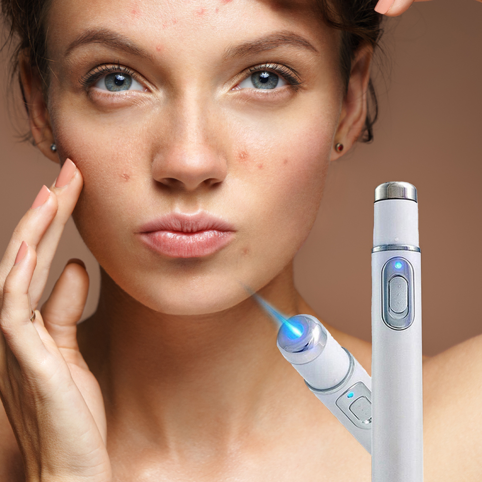 40 off on Beautify Blue Light Acne Treatment OneDayOnly